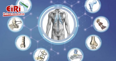 Orthopedic Implants and Instruments - Market Overview and Business Prospects